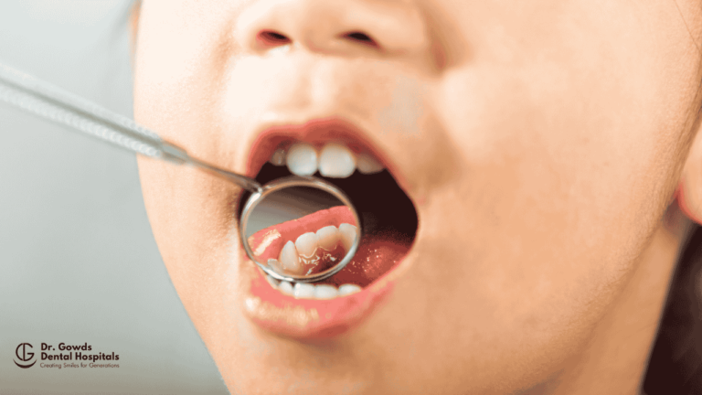 Feeding practices and their relation to cavities in children