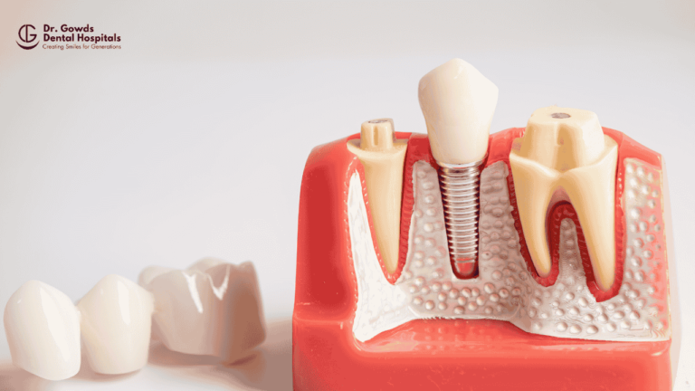 Replace missing teeth with dental implants