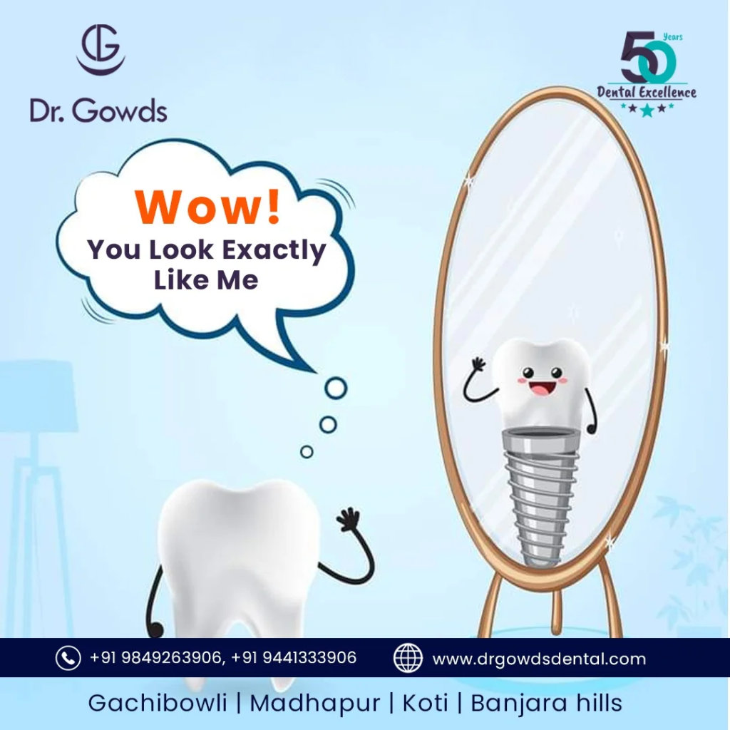 Dental Implants look and function like natural teeth